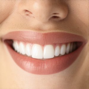 Effective Dental Crowns Guide: Achieve a Natural, Confident Smile Today