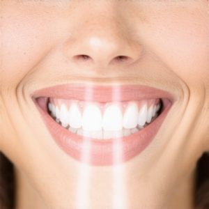 Top Cosmetic Dentistry Tips to Boost Your Smile Confidence in 2024