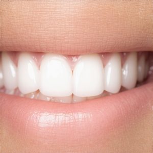 Best Cosmetic Dentistry & Crowns Tips for a Natural Smile