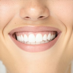 Best Cosmetic Dentistry & Crowns for Natural, Confident Smiles in 2024