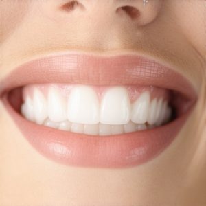 Best Crowns & Cosmetic Dentist Tips for Lasting Smiles in 2024