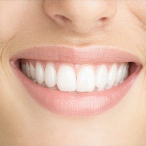 Cosmetic Dentistry Solutions: Top Tips for a Natural, Confident Smile in 14:37