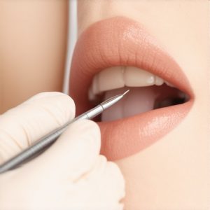 Expert Dentist Tips to Ensure Durable Crowns & Trusted Smile Care