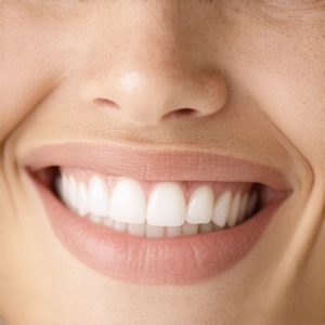 Top Cosmetic Dentistry & Crown Tips for Natural, Confident Smiles