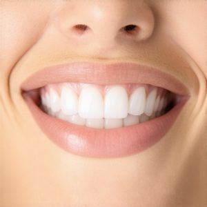 Best Cosmetic Dentistry & Crown Tips for Natural, Confident Smiles Today in 16:45