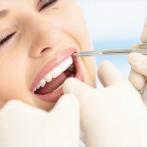 Best Dentist Tips for Lasting Crowns & Confidence in 2024