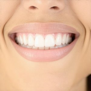 Cosmetic Dentistry & Crowns: Top Tips for a Natural, Lasting Smile