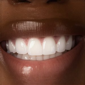 Cosmetic Dentistry Solutions: Achieve Natural Smiles with Expert Crowns Today