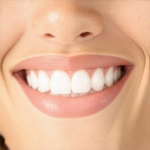 Cosmetic Dentistry Solutions: Achieve a Natural, Stunning Smile with Crowns