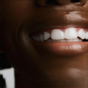 Cosmetic Dentistry Solutions: Best Crowns for Natural, Stunning Smiles