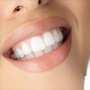 Crowns and Cosmetic Dentist Tips for Lasting Beautiful Smiles