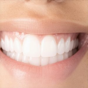 Effective Cosmetic Dentistry Secrets for Natural, Stunning Smiles