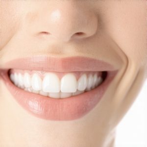 Cosmetic Dentistry: Best Crowns and Techniques for Natural Smiles in 2024