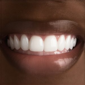 Cosmetic Dentistry: Transform Your Smile with Effective Crowns Solutions