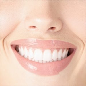 Top Cosmetic Dentistry Tips for Natural, Stunning Smiles 2024