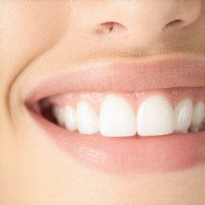 Why 2026 Cosmetic Dentistry is Shifting from Porcelain