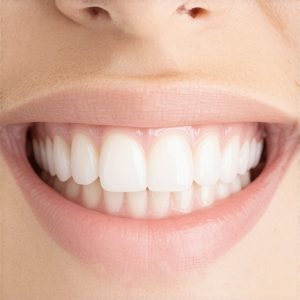5 Habits That Ruin Your 2026 Cosmetic Smile Makeover