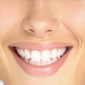 Is Your 2026 Cosmetic Smile Upgrade Using Smart-Veneer Tech?
