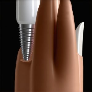 Why 2026 Ceramic Implants Beat Titanium for Long-Term Health