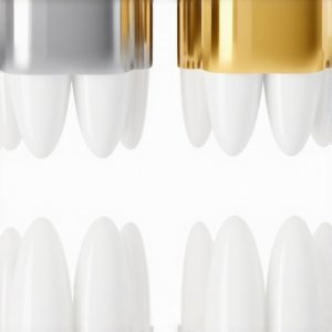 Why Graphene Crowns are Replacing Porcelain Models in 2026