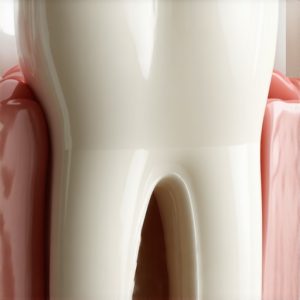 Why Hybrid Resin Crowns Last Twice as Long in 2026