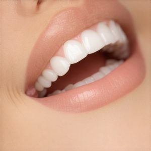 4 Signs Your Cosmetic Dentist Still Uses Cheap 2025 Resin