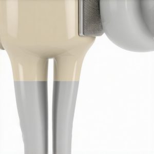 Stop 2026 Crown Sensitivity: 4 New Bonding Steps That Work