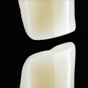 Why 2026 Resin-Glass Crowns Outlast Ceramic Models