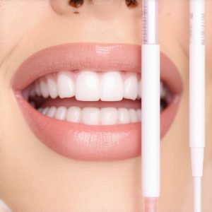 3 New Saliva Tests That Predict Cavities 6 Months Early [2026]