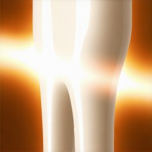 4 Ways 2026 Cold-Laser Whitening Protects Your Enamel