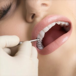 Why 2026 Family Dentistry Now Includes Oral Microbiome Tests