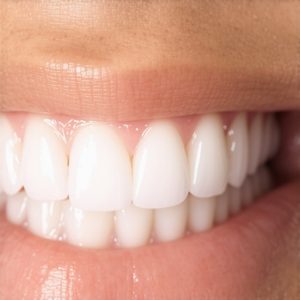 Why 2026 Zirconia-Plus Crowns Don't Cause Gum Discoloration